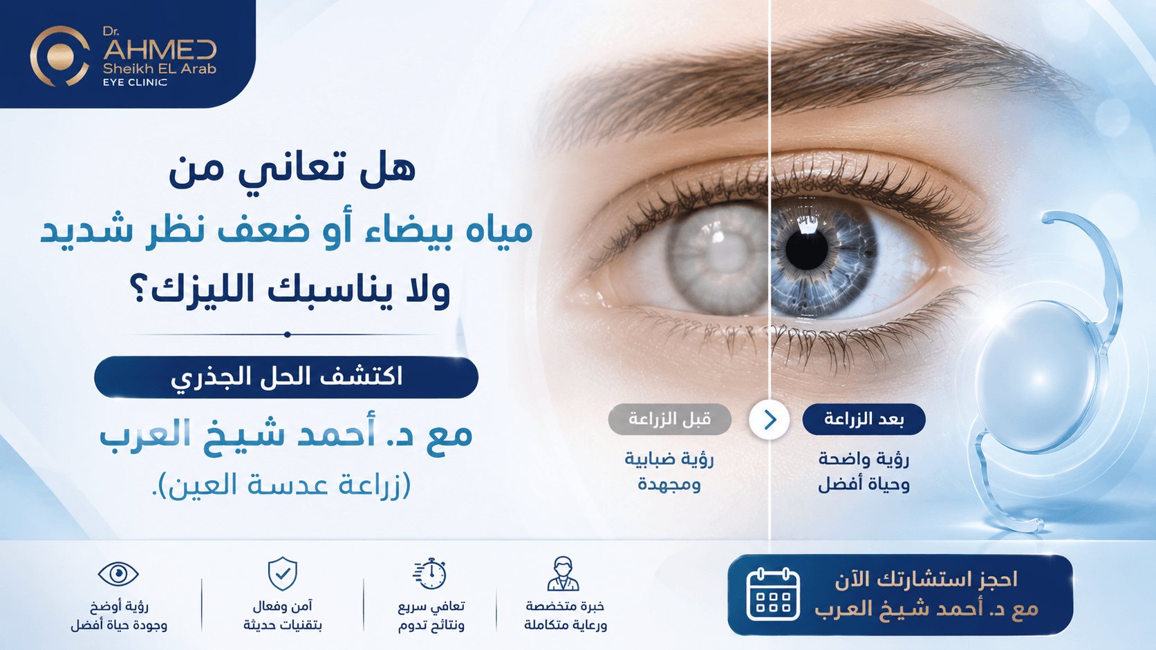 تصميم مقال زراعة عدسة العين