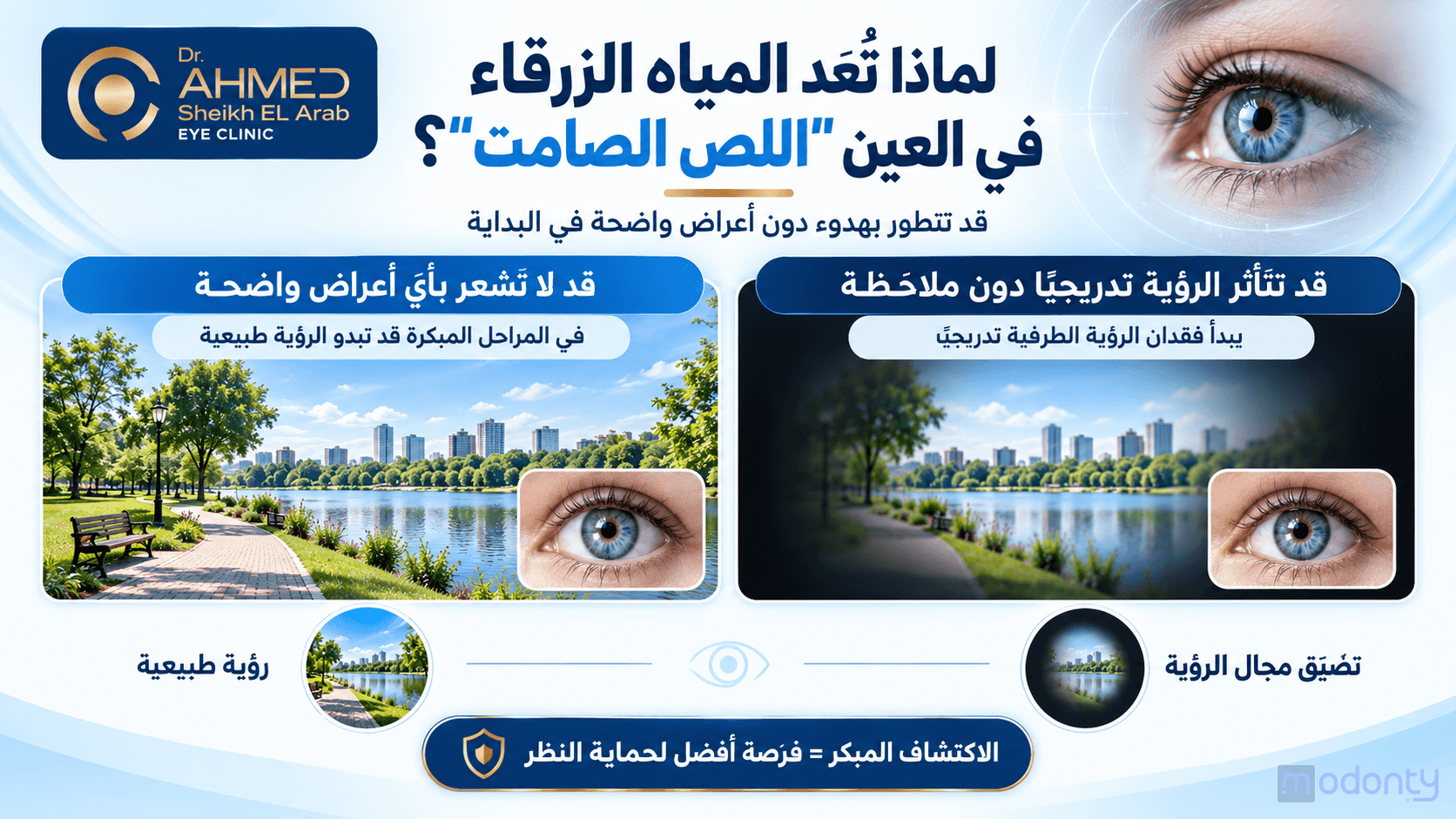 تصميم مقال المياه البيضاء