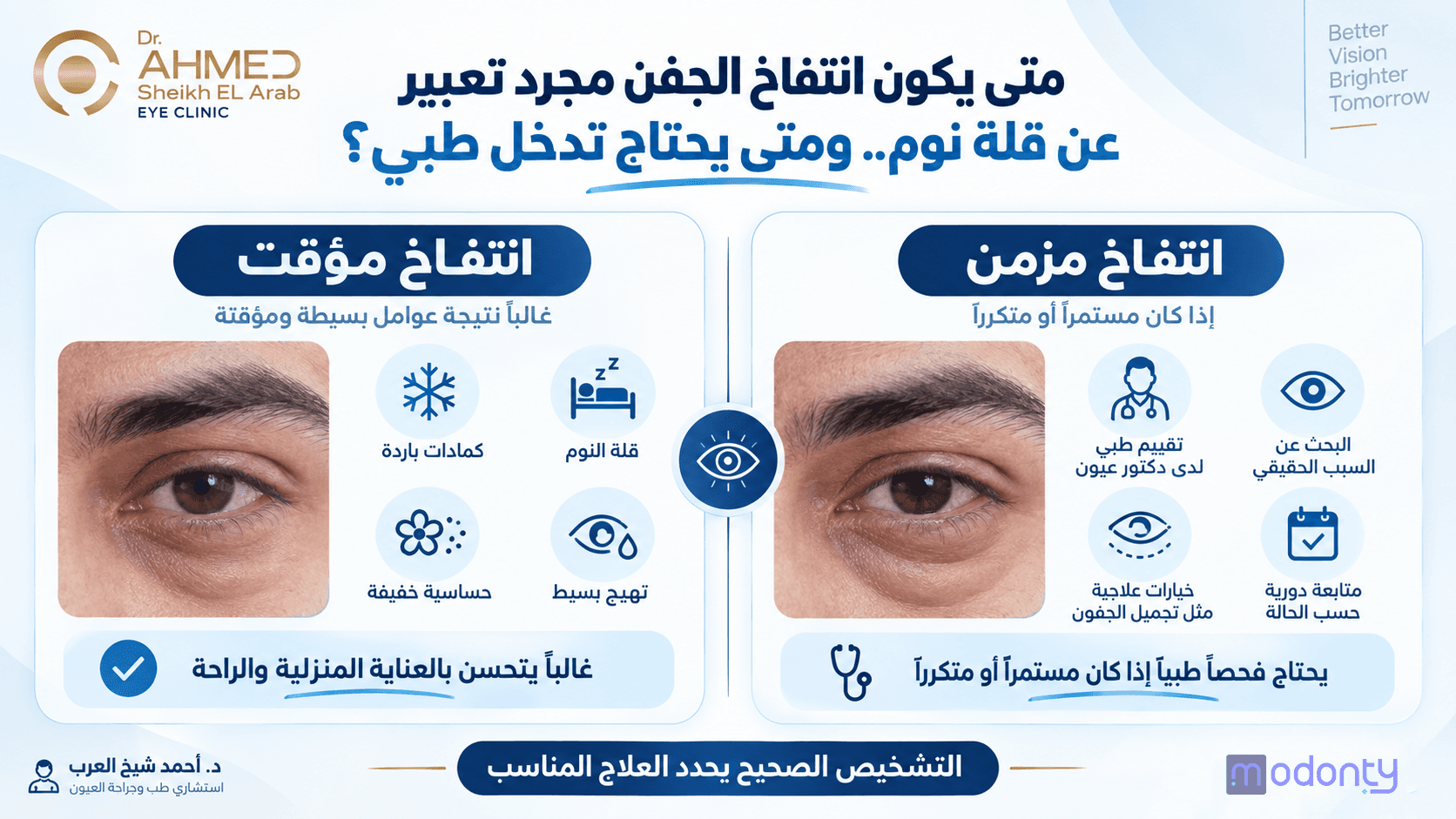 تصميم مقاال انتفاخ الجفون