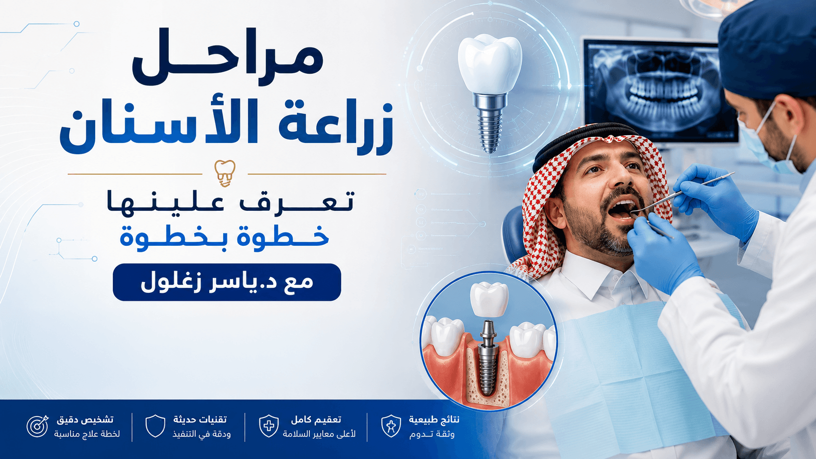 مقال 2