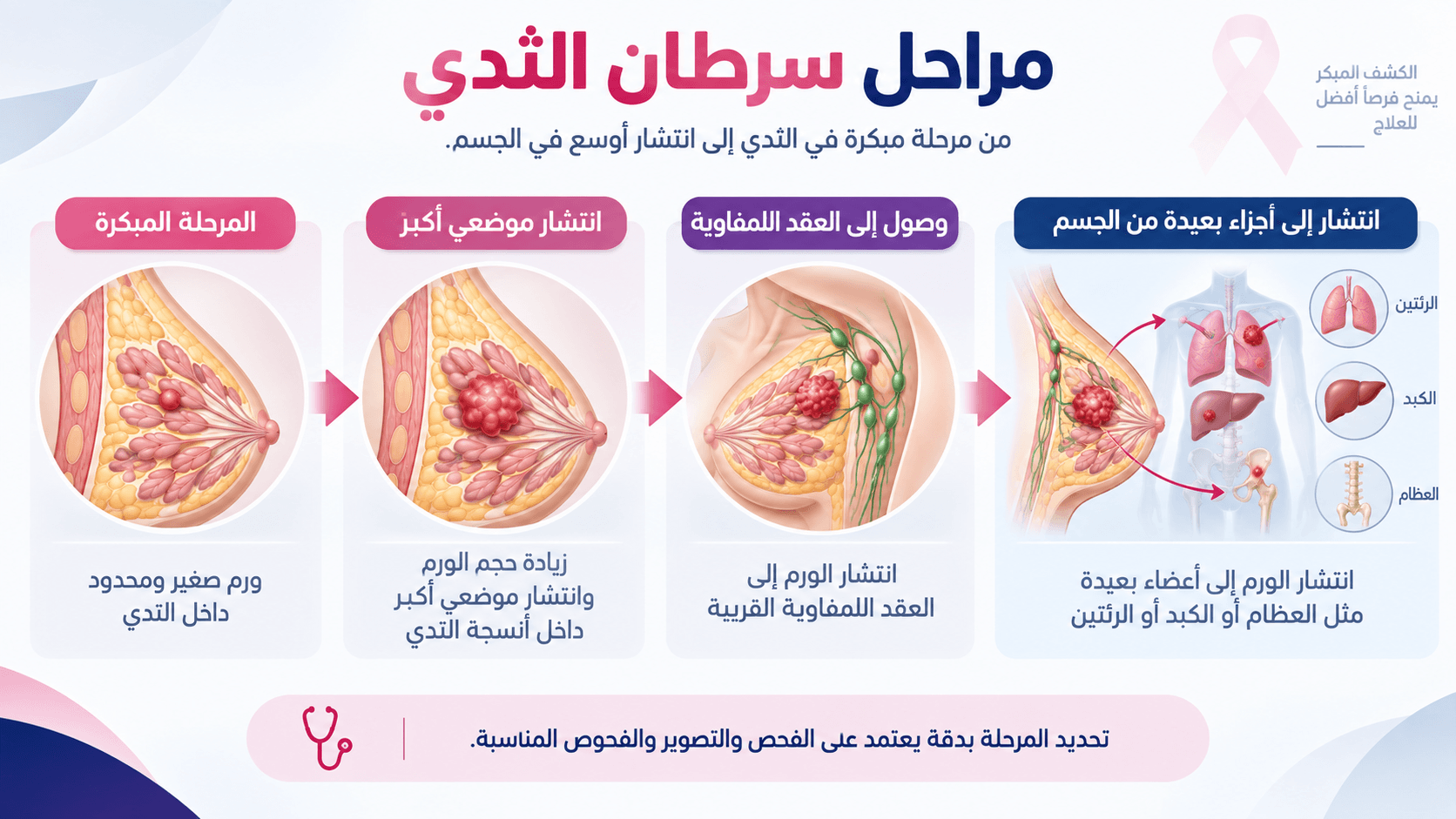تصميم مقال بيلر