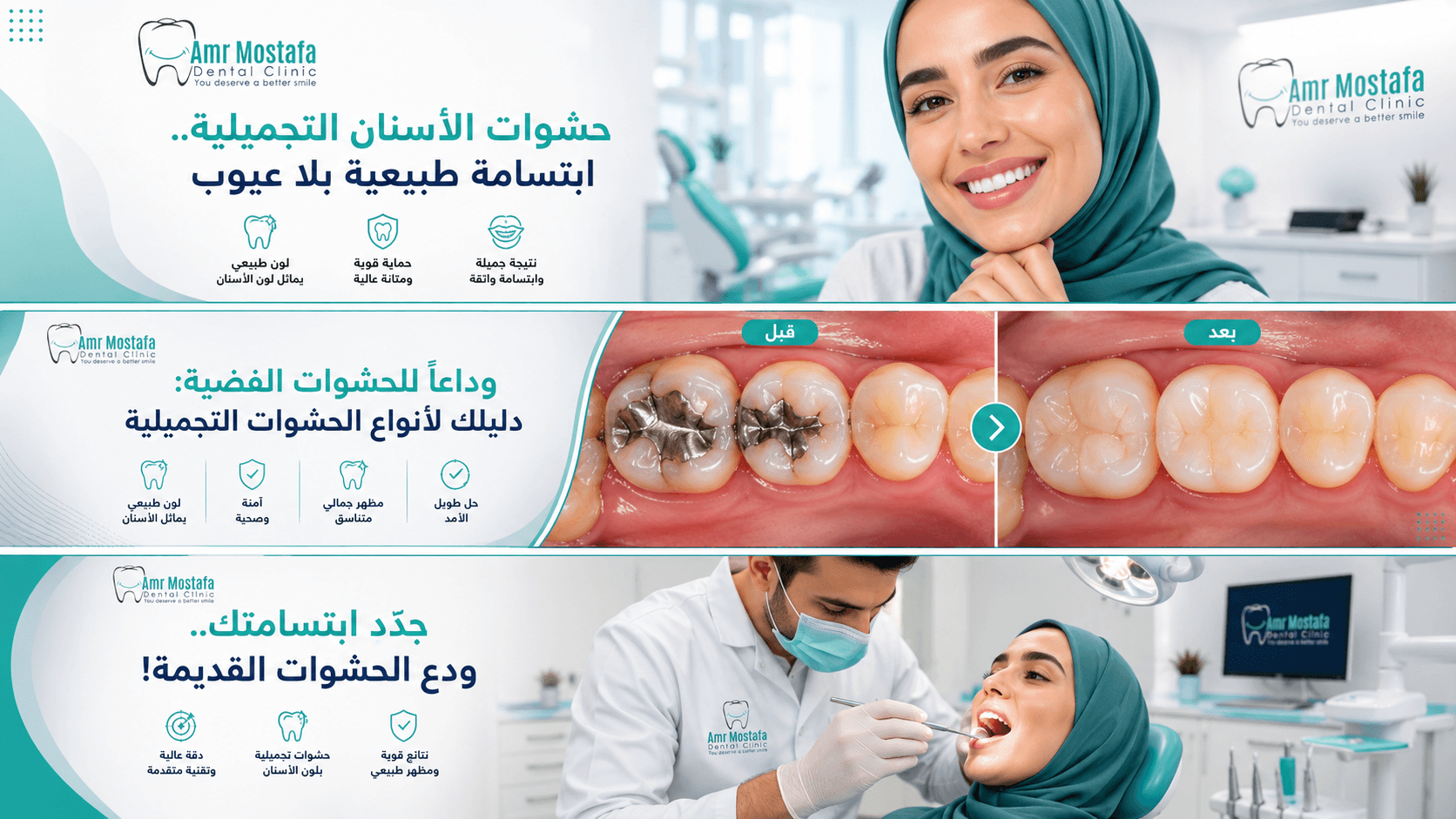 تصميم مقال حشوات الأسنان التجميلية