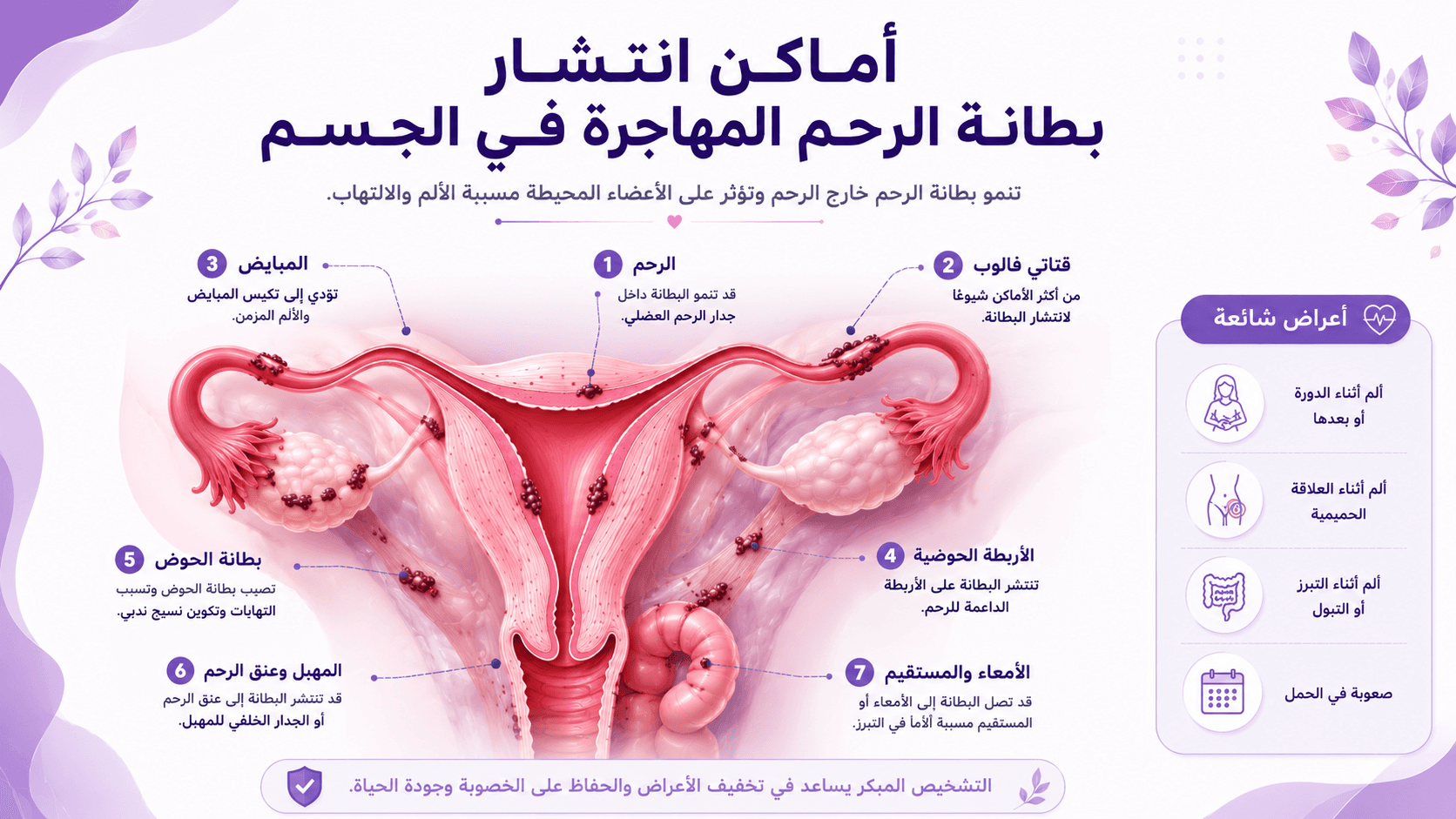 تصميم مقال بطانة الرحم المهاجرة 4