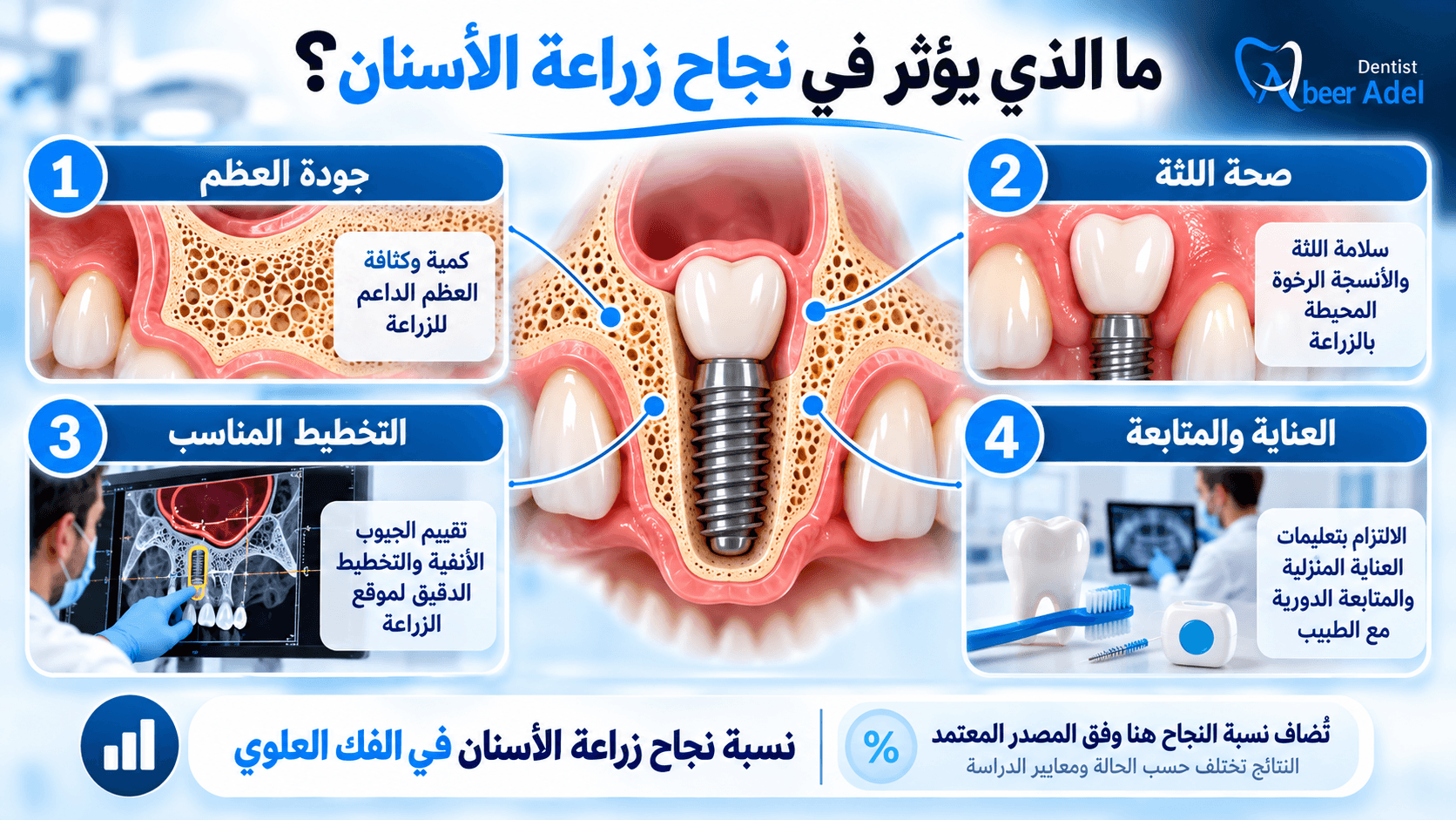تصميم مقال بيلر