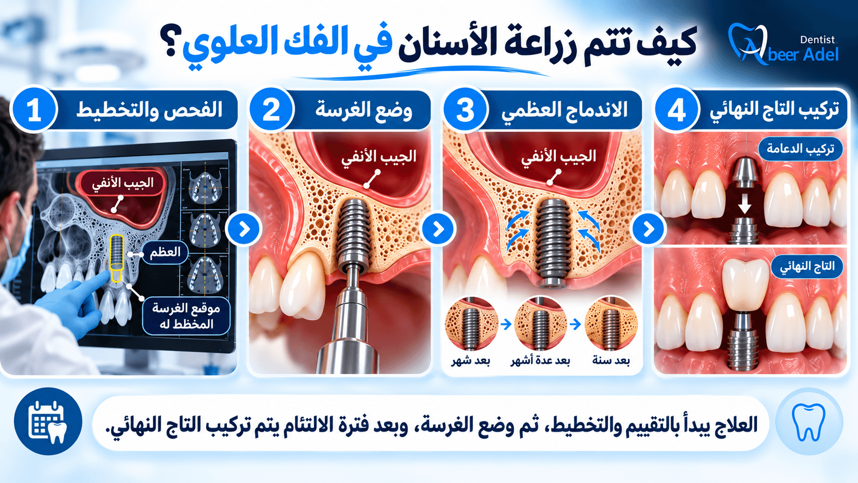 تصميم مقال بيلر
