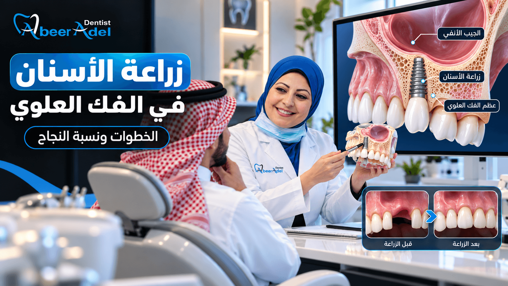 تصميم مقال بيلر