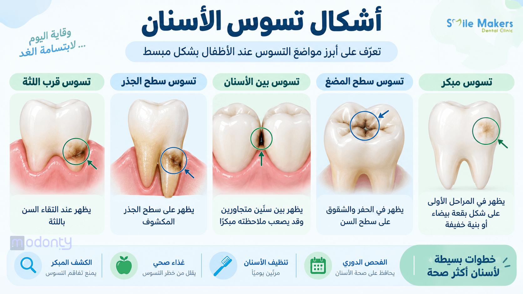 تصميم مقال 2 ( تسوس الأسنان للأطفال)